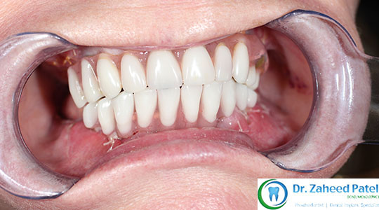 Case 4 after treatment
