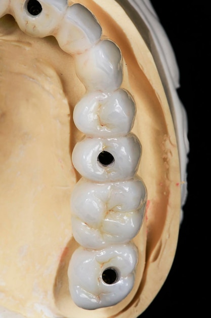 Full & Partial Oral Rehabilitation