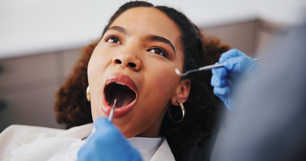 Oral Cancer Biopsy