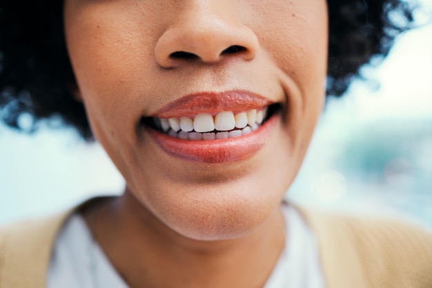 Periodontal Aesthetic Procedures